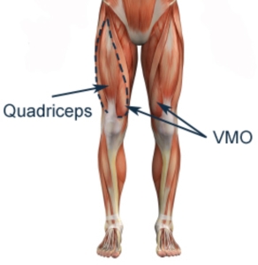 http://www.physioadvisor.com.au/8290850/quadriceps-strengthening-exercises-vmo-strengthe.htm